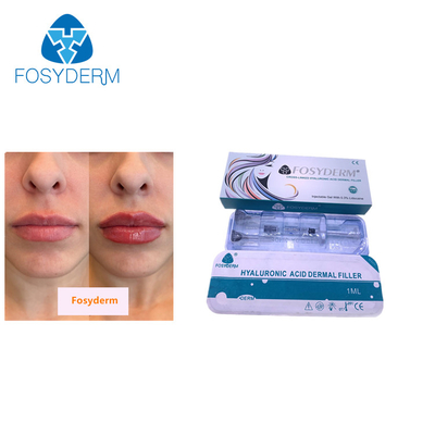 Syringe Packaging Hyaluronic Acid Facial Filler Smooth Texture MOQ 1Box