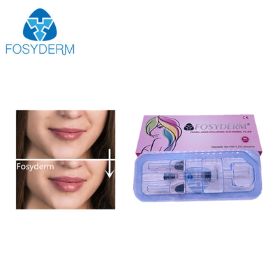 2ml Filler Hyaluronic Acid Dermal Filler For Face Nose Lip Enlargement 24mg/ml