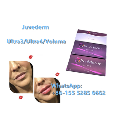 Juvederm Ultra4 24mg/Ml Dermal Filler Anti Wrinkles Hyaluronic Acid Injection