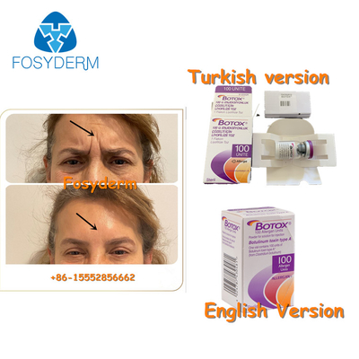 100 Units Type A Botulinum Toxin Allergan Anti Facial Wrinkles Botox Botulax Injection