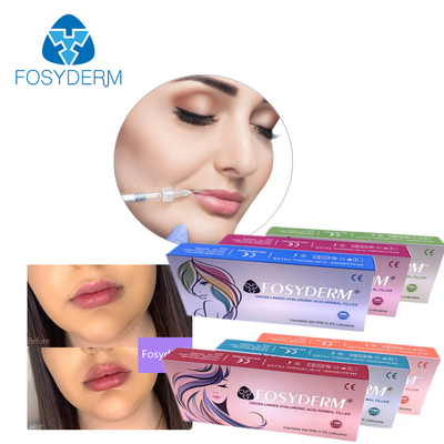 Hyaluronic Acid Injectable Dermal Filler 1ml 2ml For Lips Augmentation