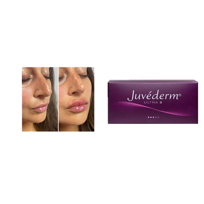 Juvederm 2*1ml Cross Linked Dermal Filler Anti Wrinkles Facial Filler