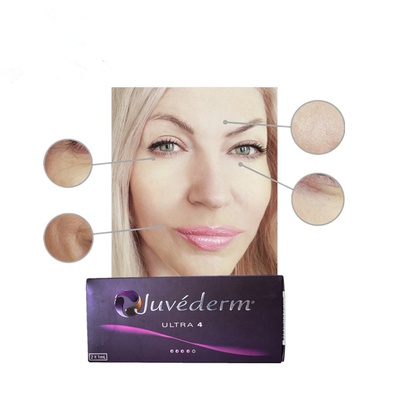 Juvederm Ultral 4 Hyaluronic Acid Dermal Filler Injections With Lidocaine